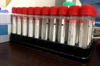 Piłkarze PGE Stali Mielec przeszli testy. Dziś poznają wyniki